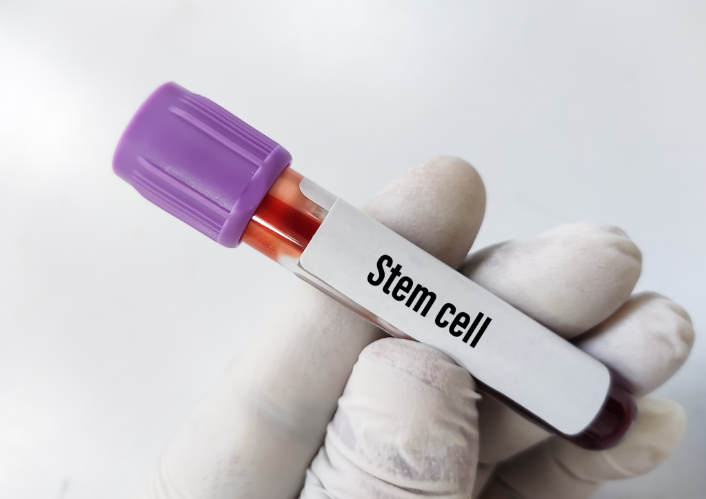Stem Cell Proses Regenerasi Sel Tubuh